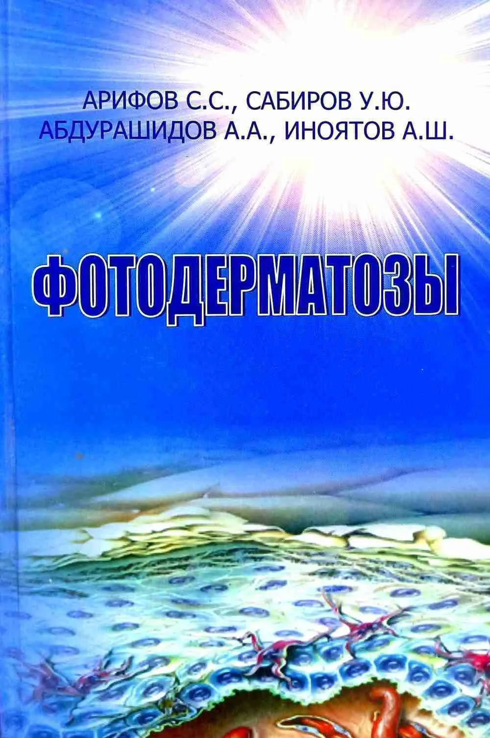 Фотодерматозы